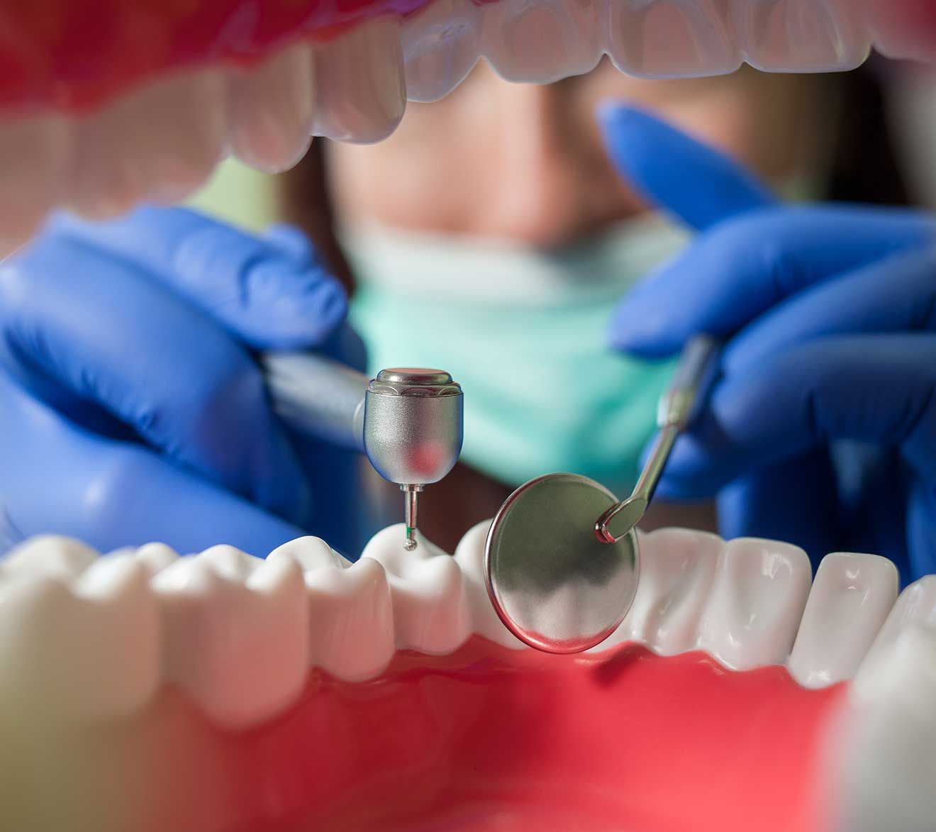 ESPECIALIDAD-EN-PERIODONCIA-E-IMPLANTOLOGÍA-ORAL
