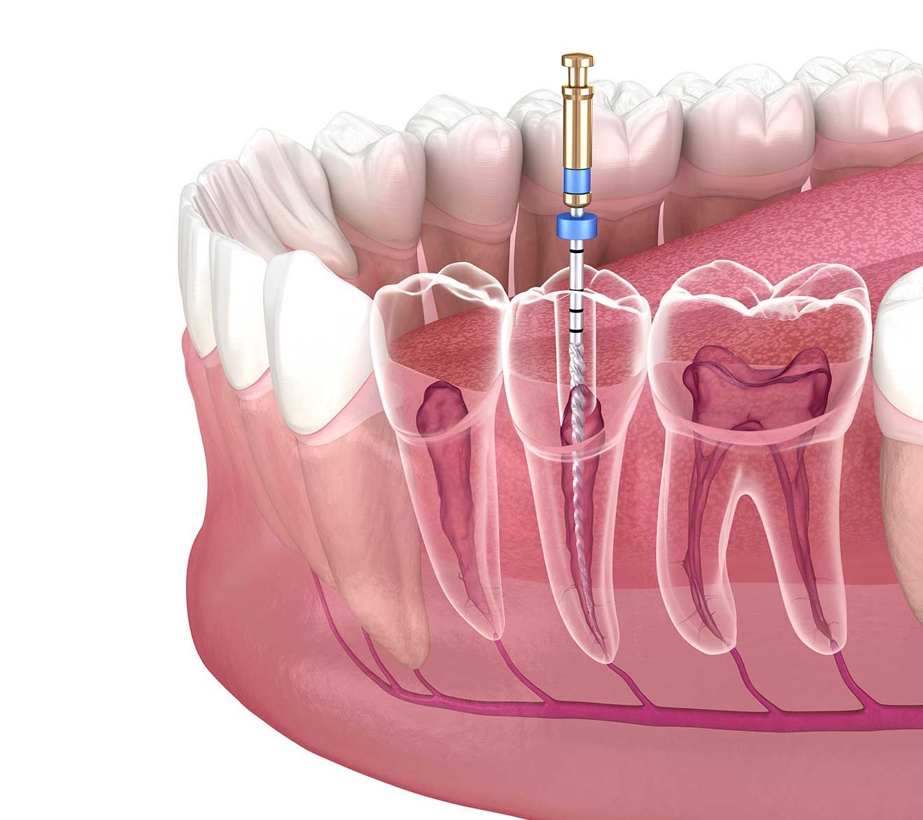 Especialidad-Endodoncia