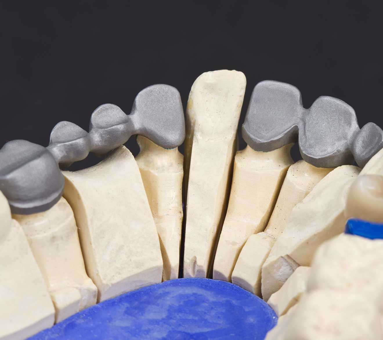 Especialidad-Rehabilitación-Oral-Avanzada