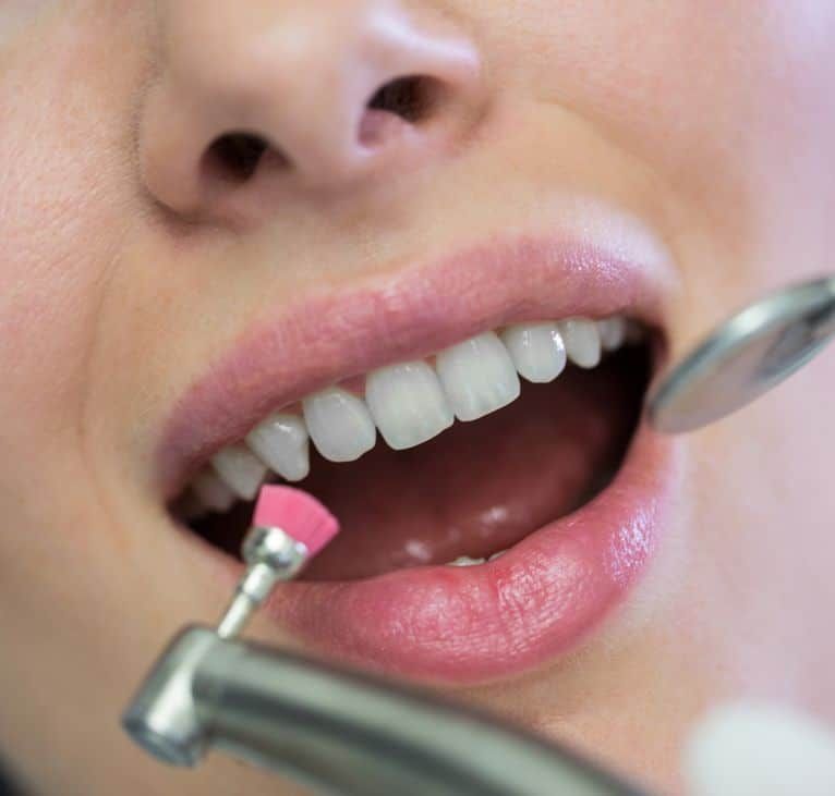 Dentist examining a female patient with tools at dental clinic