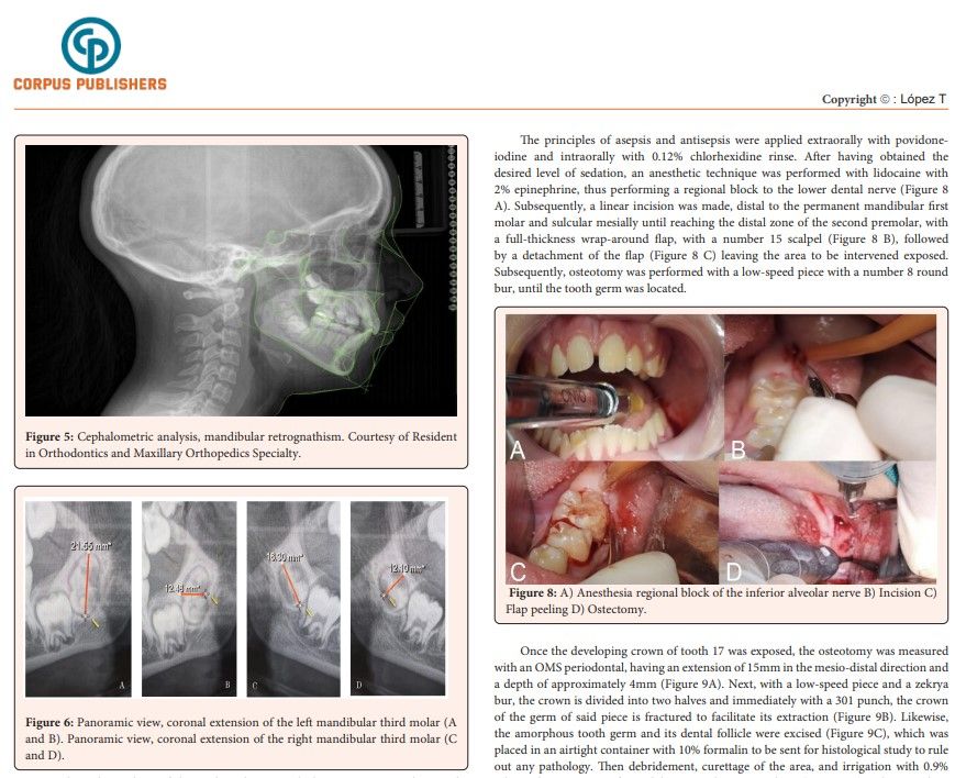revista internacional